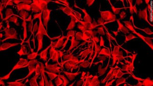 t1larg.stem.cells.neuralstem